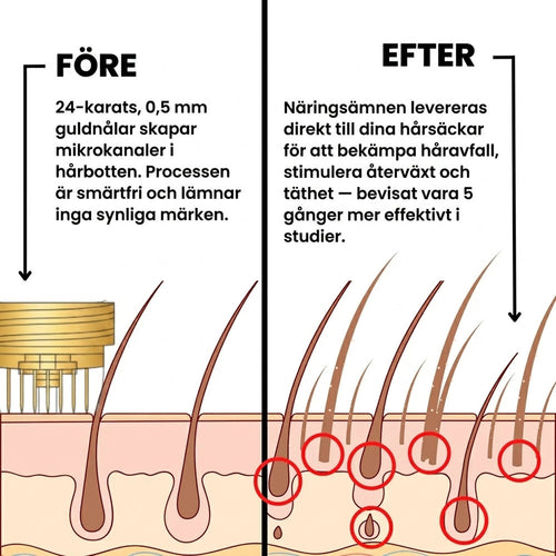 SeekPretty Hair System™