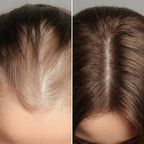 SeekPretty Hair System™