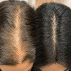SeekPretty Hair System™