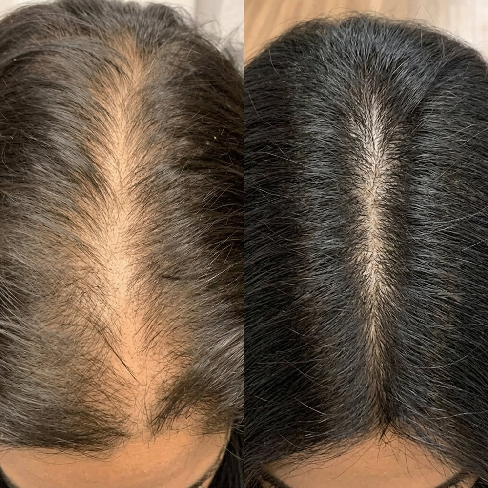 SeekPretty Hair System™