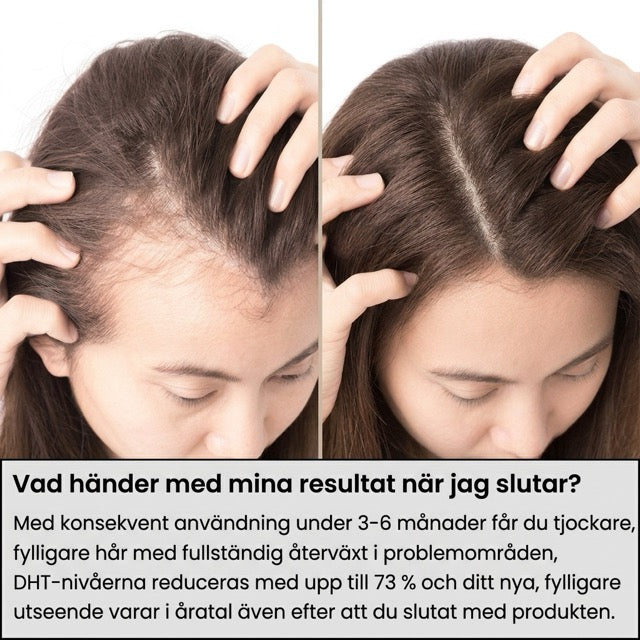 SeekPretty Hair System™